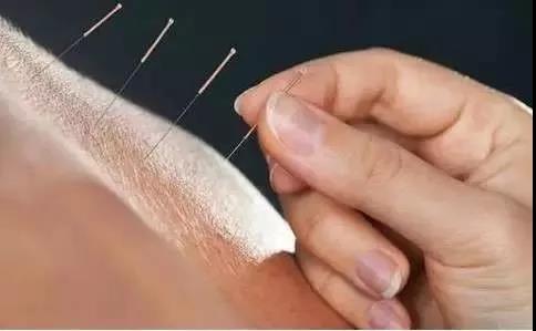 微信圖片_20180312100428.jpg 微信圖片_20180312100428.jpg