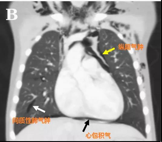 微信圖片_20200425210447.jpg 微信圖片_20200425210447.jpg