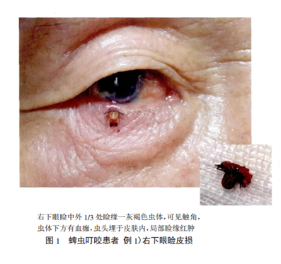 微信圖片_20200428142027.png 微信圖片_20200428142027.png